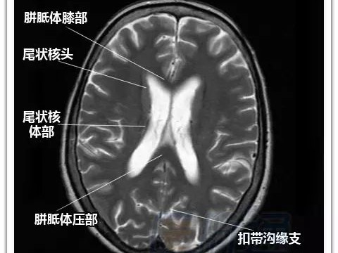  Is MRI Better Than PET Scan? A Comprehensive Comparison of Imaging Techniques for Accurate Diagnosis